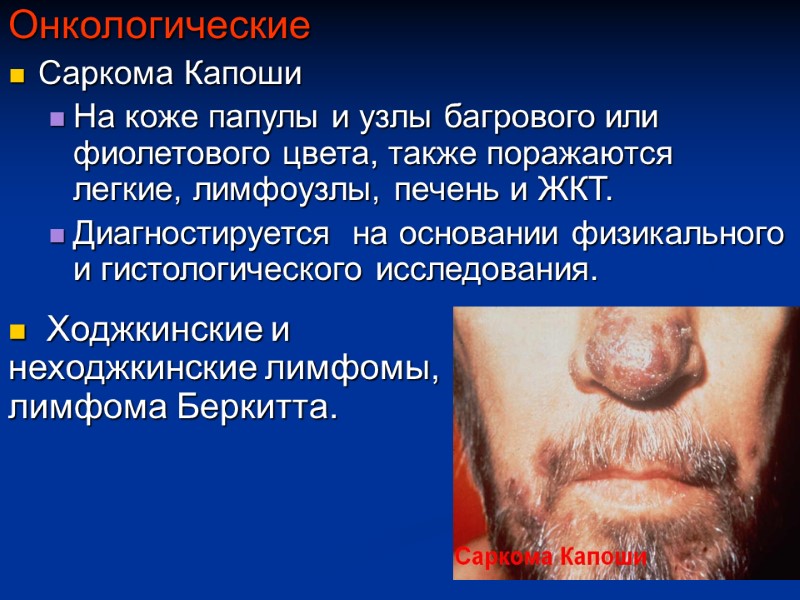 Онкологические Саркома Капоши На коже папулы и узлы багрового или фиолетового цвета, также поражаются